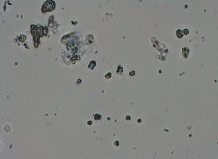 Dictyocha speculum